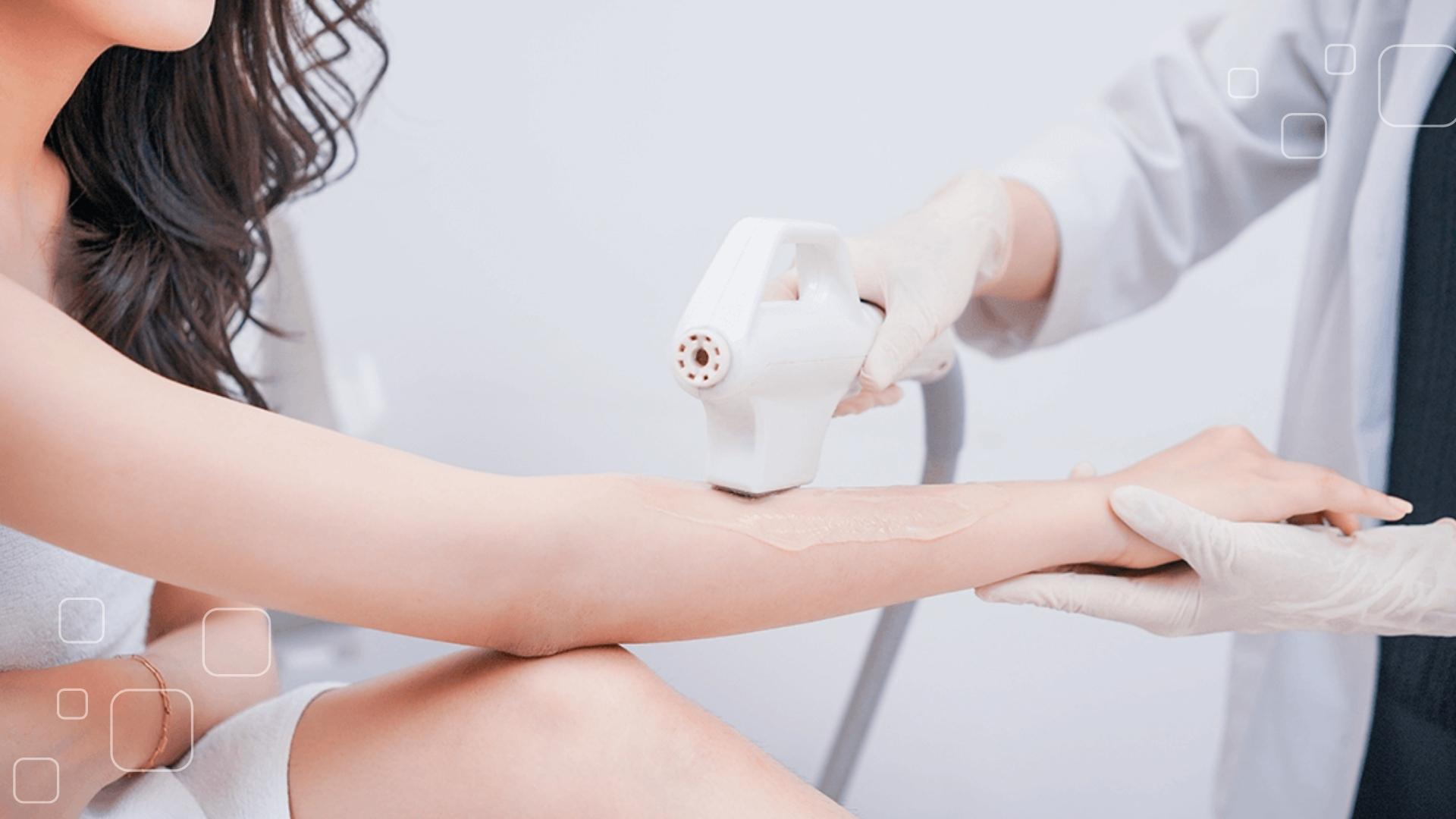 Lợi ích và nhược điểm của triệt lông bằng laser