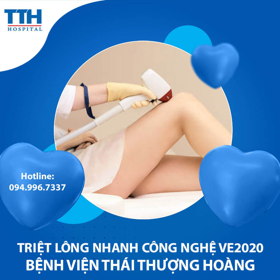 Triệt lông bằng công nghệ ánh sáng