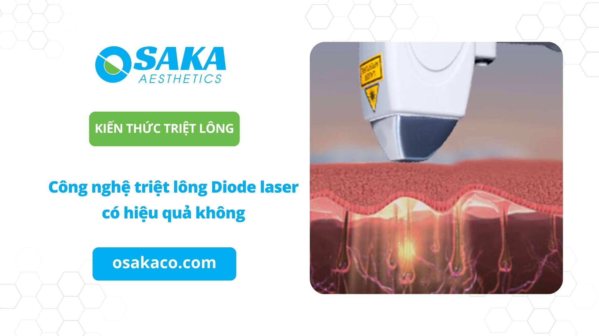 Triệt lông bằng tia laser có hại không?